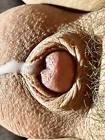 Tiny penis, micro, cock, inverted cock photos